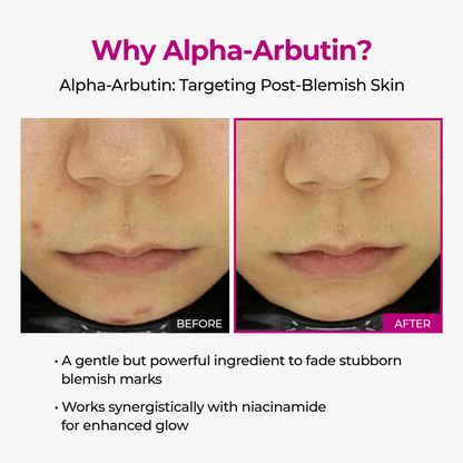 Dr.Melaxin Lumi firm & lift Duo